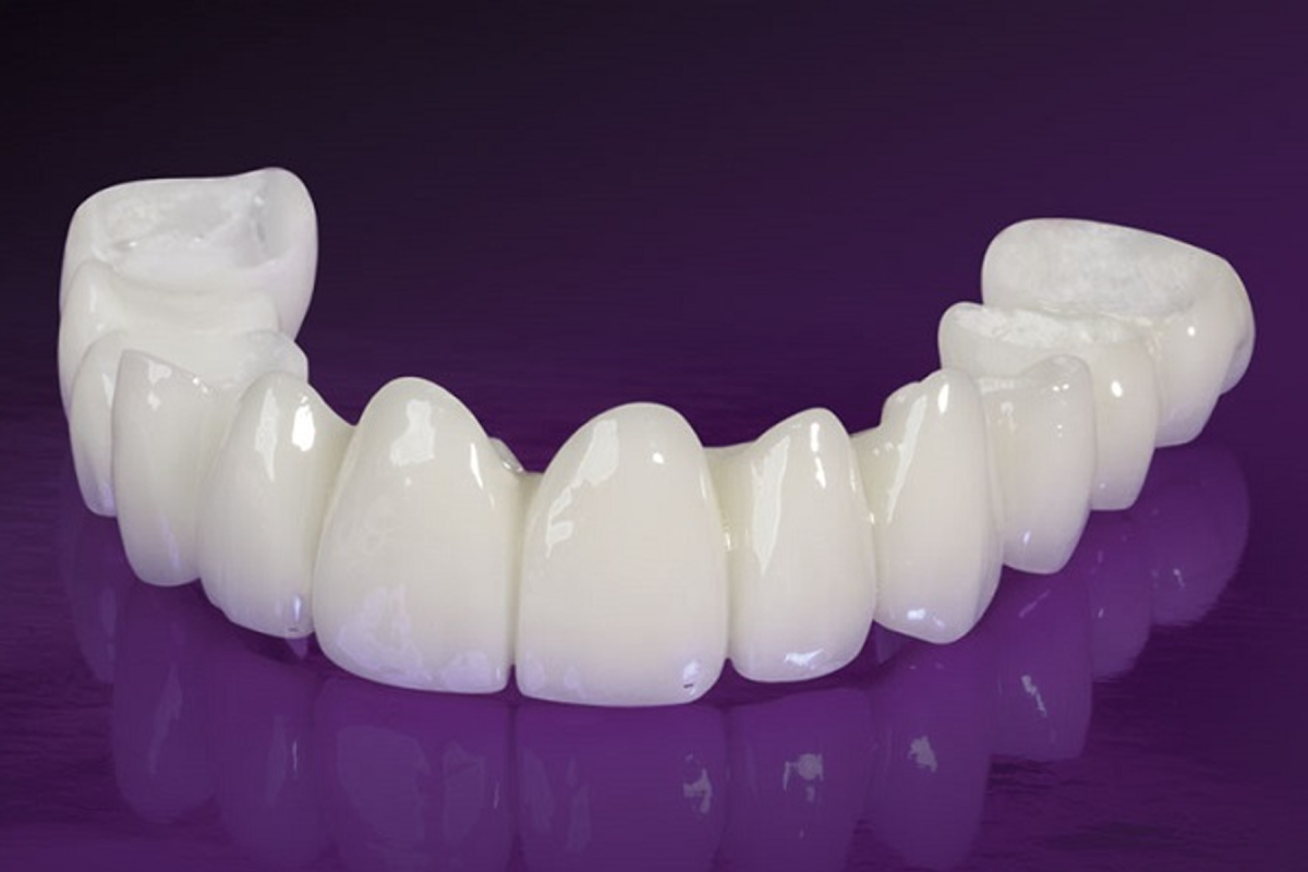 hình ảnh thực tế Ceramill Zolid HT+