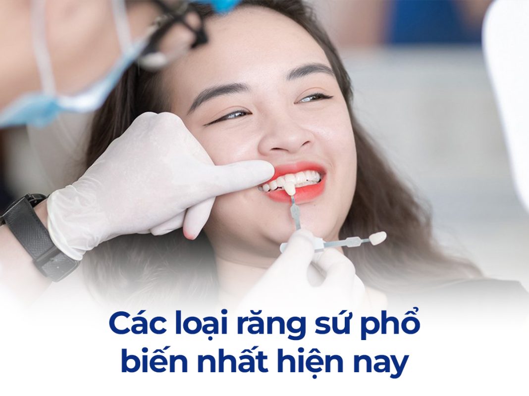 Các loại răng sứ phổ biến nhất hiện nay