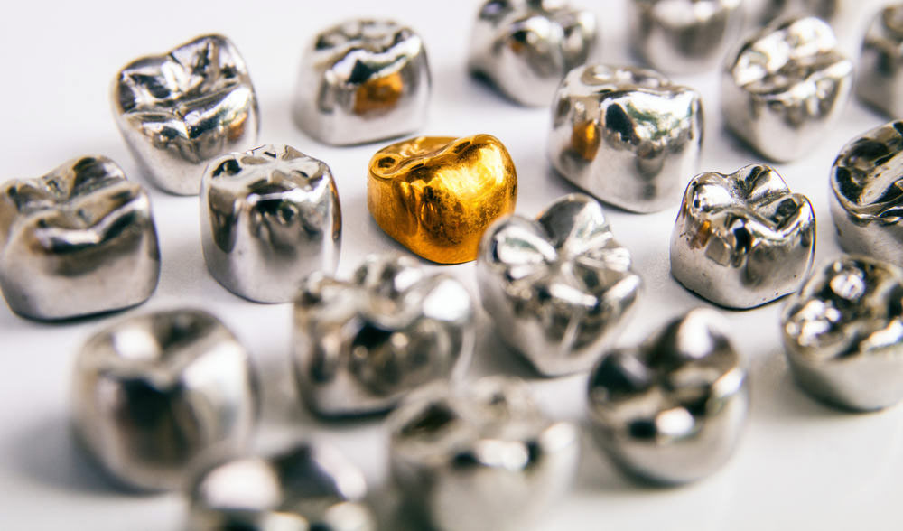 Răng sứ kim loại quý