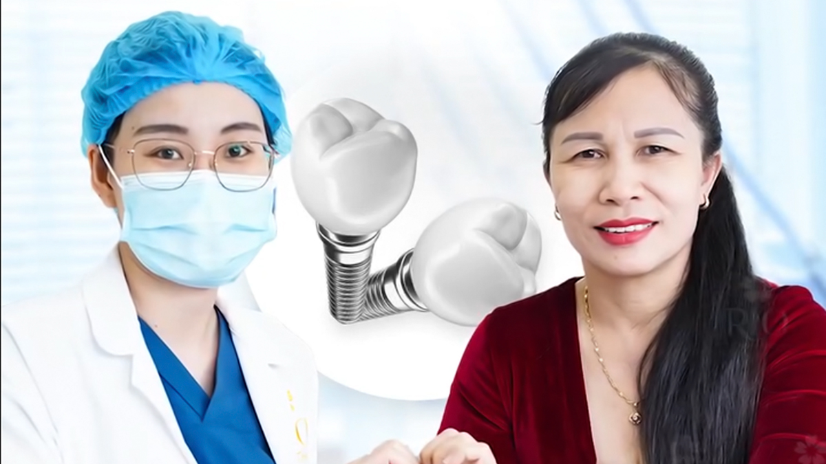 Trải nghiệm trồng răng của cô TOÁN tại Nha khoa Rio