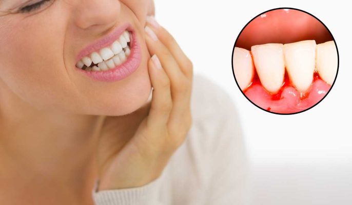các bệnh lý về răng miệng