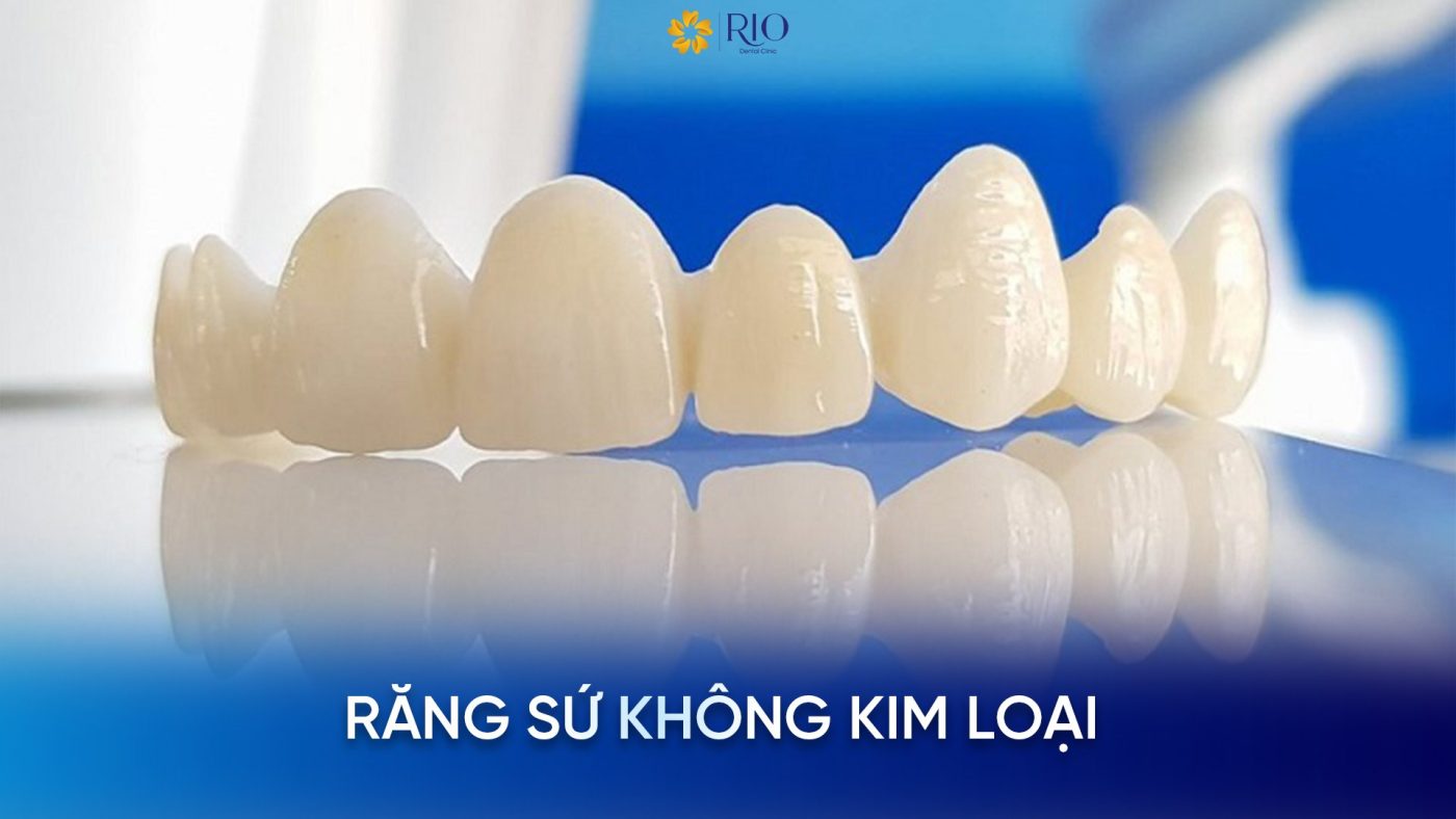 Các loại răng sứ không kim loại
