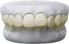 Hình 3D răng ố vàng