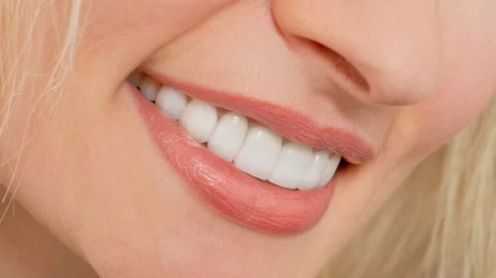 Bọc răng sứ - Ưu điểm và nhược điểm