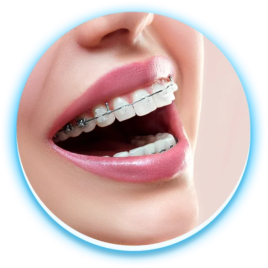 nieng-rang-mac-cai-pha-le