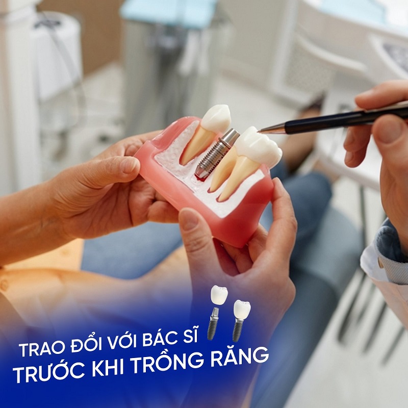 Lưu ý khi trồng răng Implant
