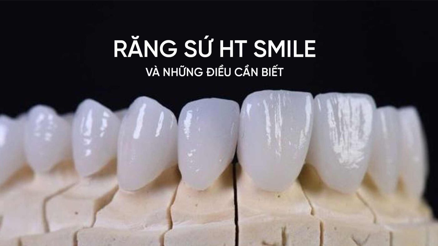 Răng sứ HT Smile và những điều cần biết