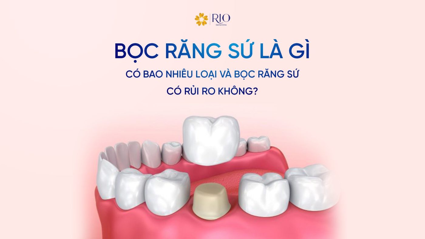 Bọc răng sứ là gì? Có bao nhiêu loại và bọc răng sứ có rủi ro không?