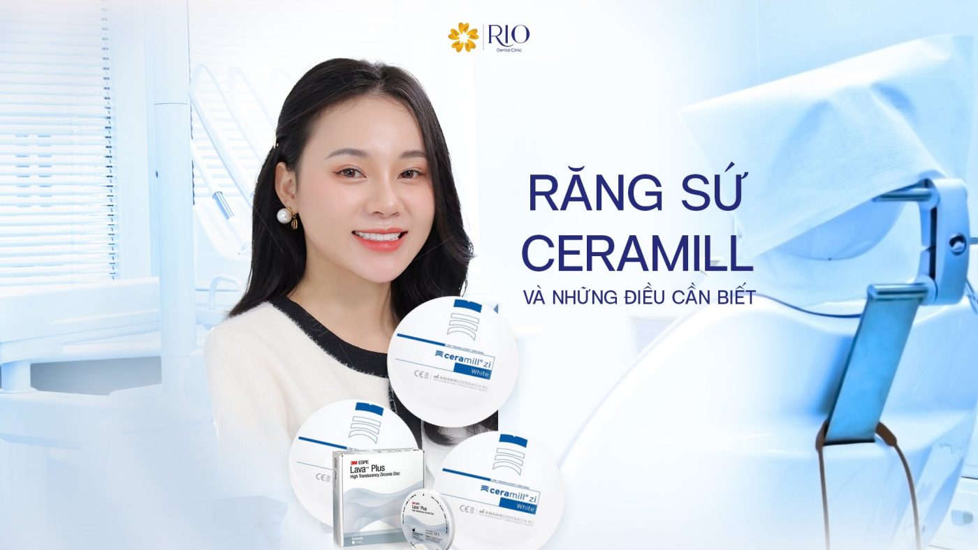 Răng sứ Ceramill và những điều cần biết