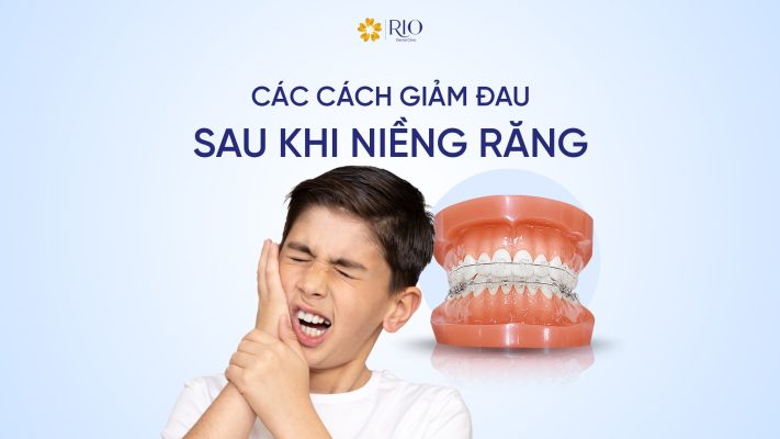 Giảm đau sau khi niềng răng