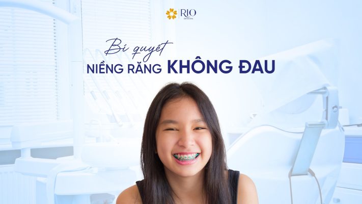 Giảm đau sau khi niềng răng