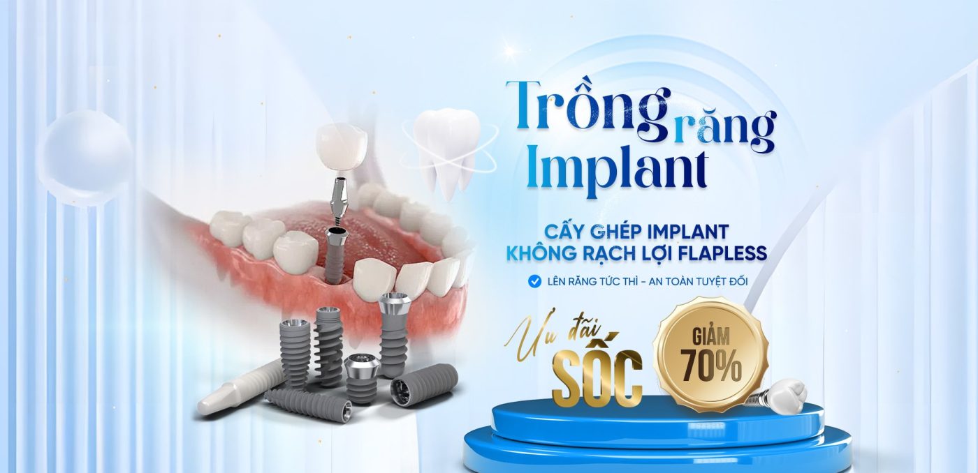 Trồng răng Implant