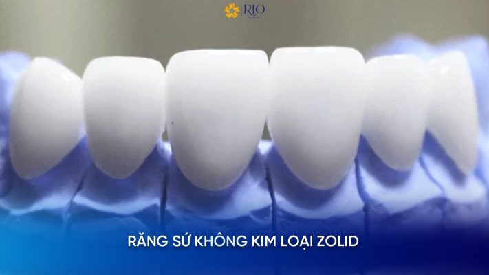 răng sứ không kim loại là gì?