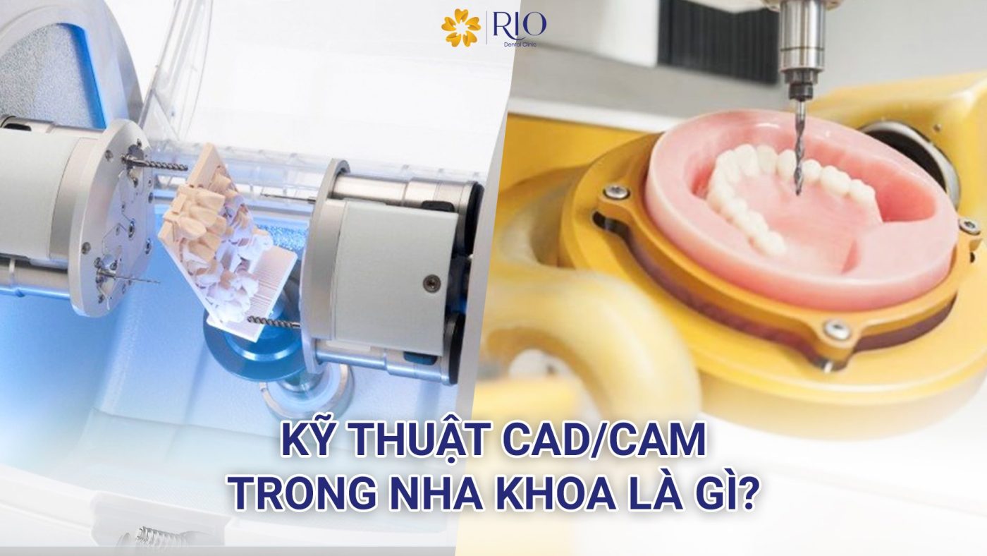 Công nghệ CAD/CAM