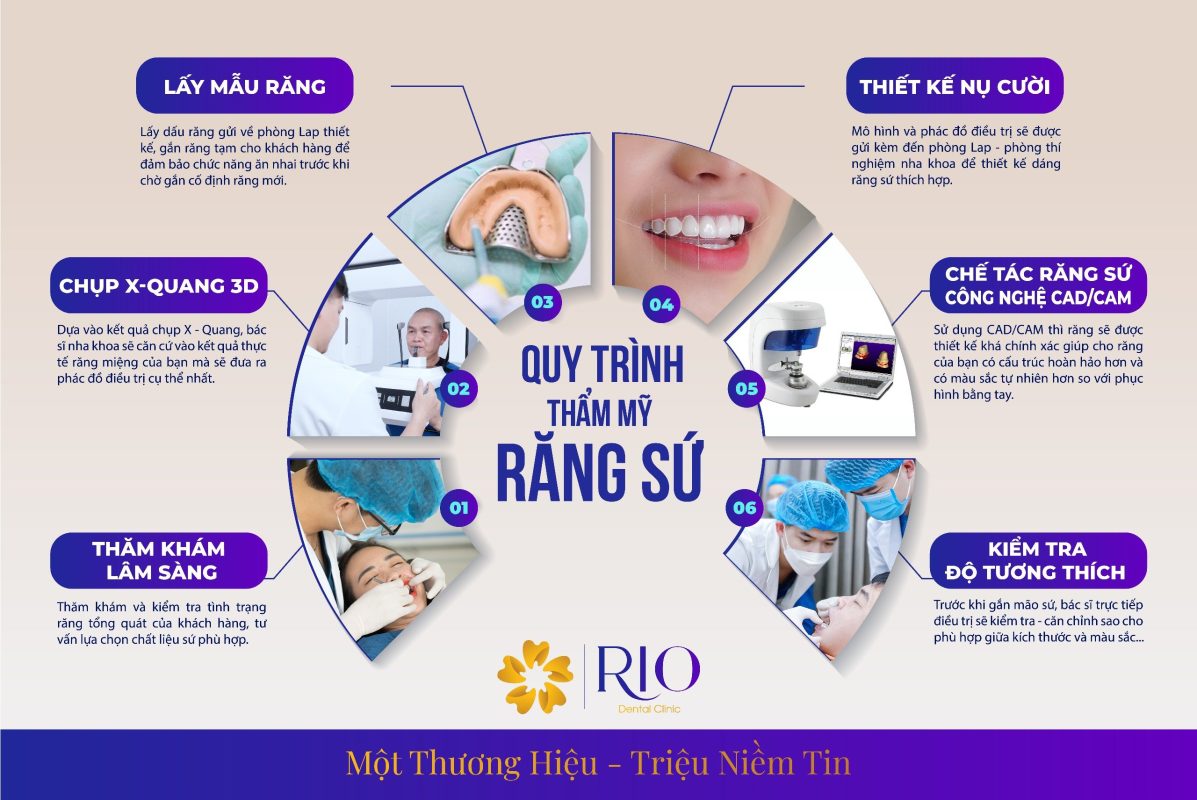 Quy trình bọc răng sứ thẩm mỹ Quy trình thẩm mỹ răng sứ tại Nha khoa Rio