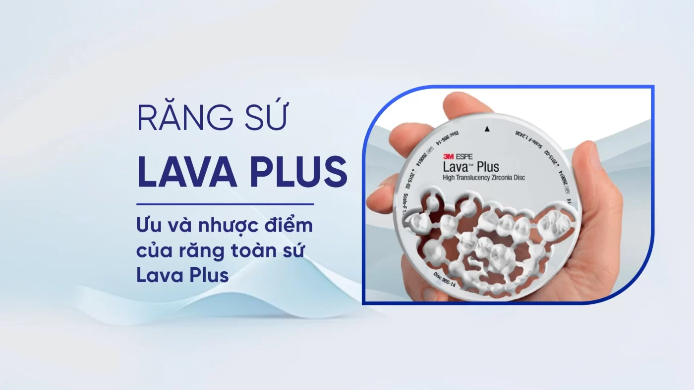 rang-su-lava-plus-nhakhoario