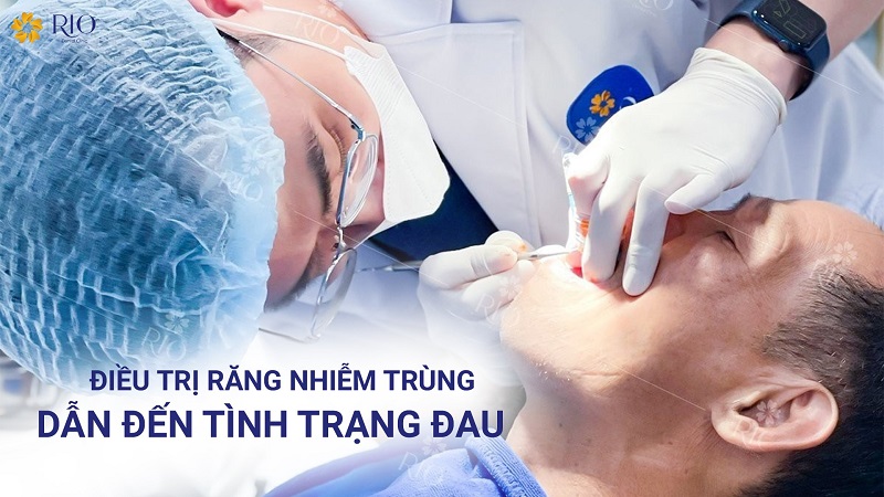 Điều trị Đau răng cuối hàm dưới