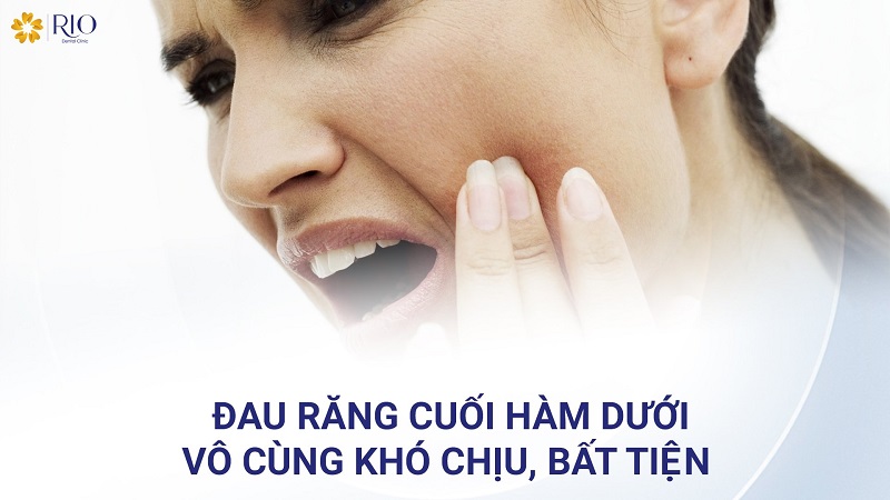 Đau răng cuối hàm dưới