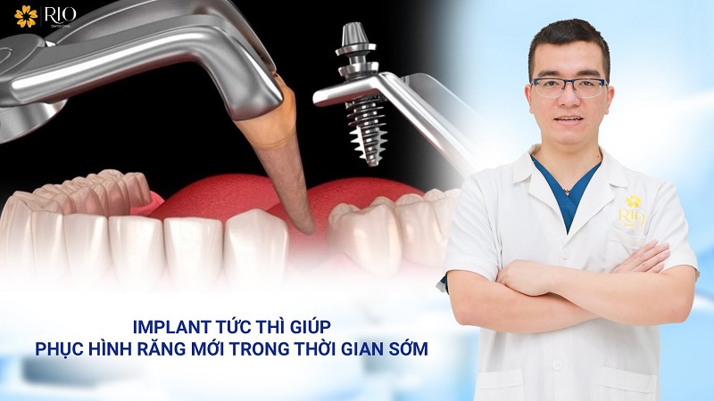 Implant tức thì