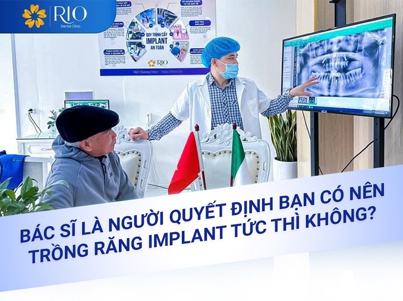 Implant tức thì thực hiện khi nào