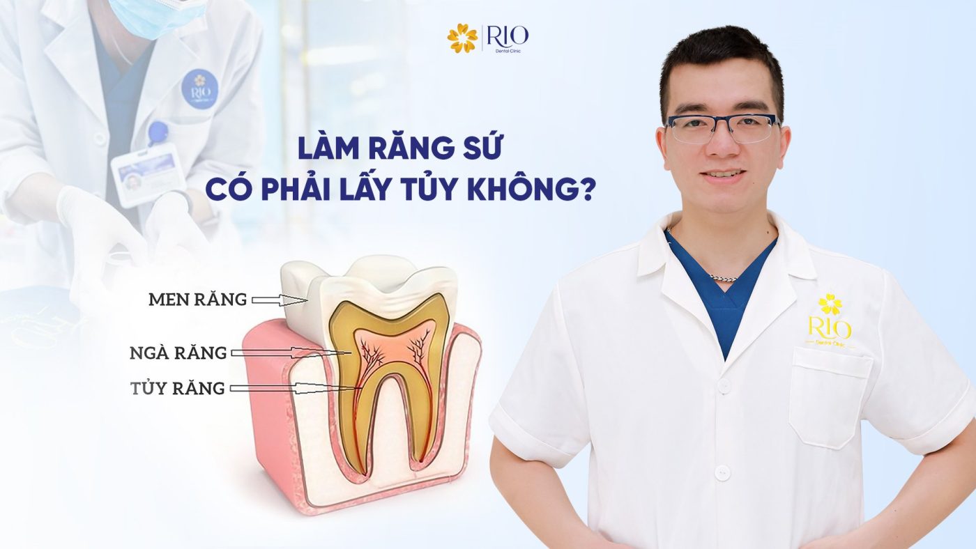 Làm răng sứ có phải lấy tủy không?