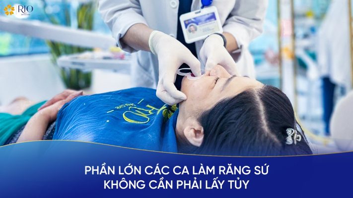 Làm răng sứ có phải lấy tủy không?