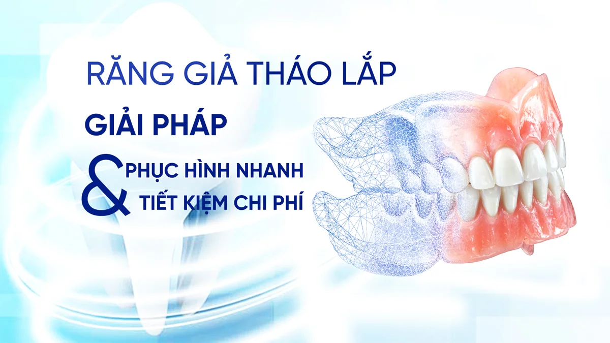 rang-gia-thao-lap-nha-khoa-rio