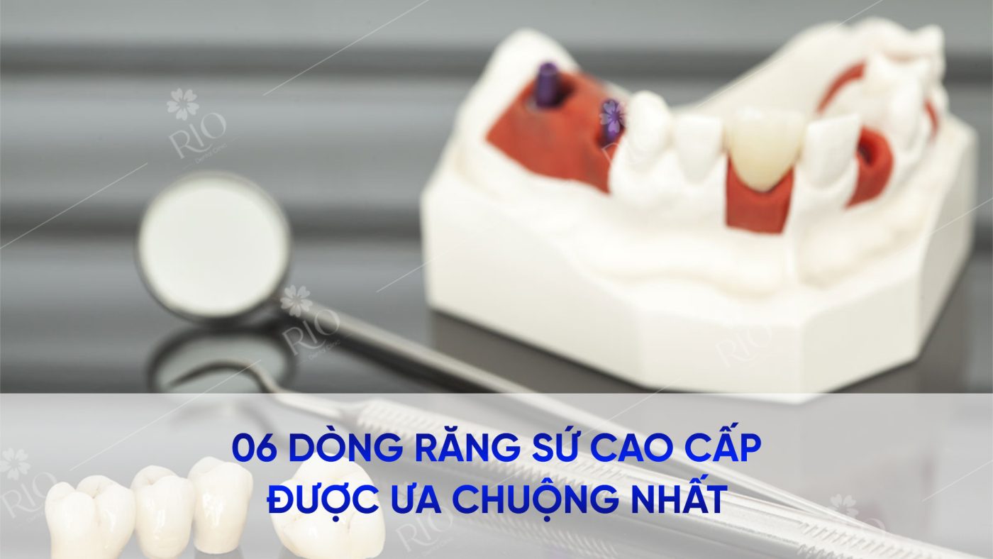 06 dòng răng sứ cao cấp được ưa chuộng nhất