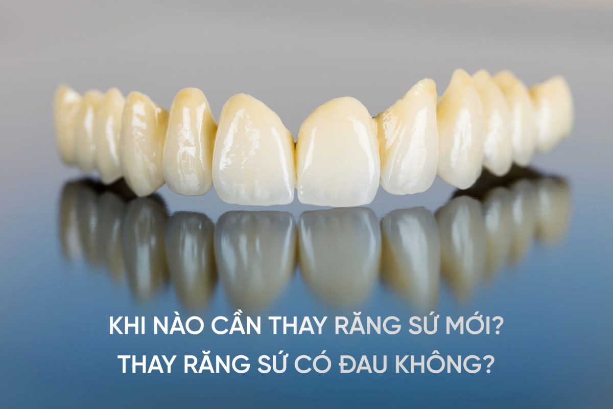 khi-nào-cần-thay-răng-sứ-mới