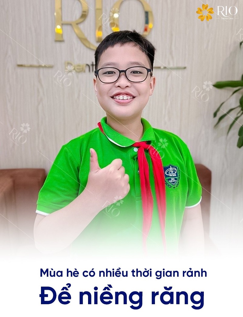 Mùa hè thời gian lý tưởng để đi niềng răng