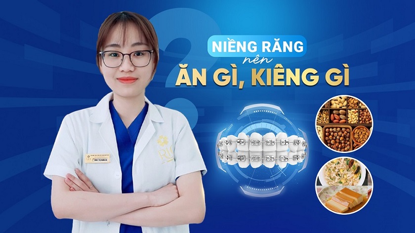 Niềng răng nên ăn gì