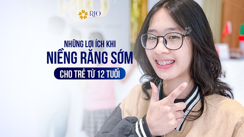 Lợi ích khi niềng răng sớm cho trẻ