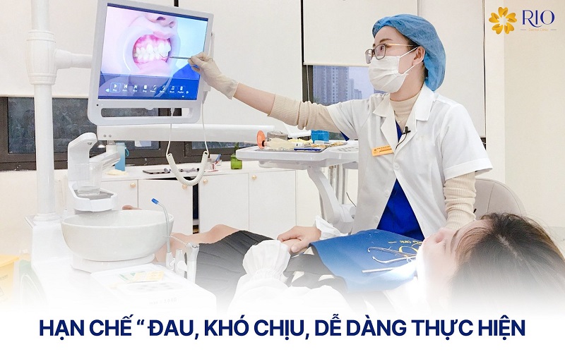Niềng răng sớm cho trẻ