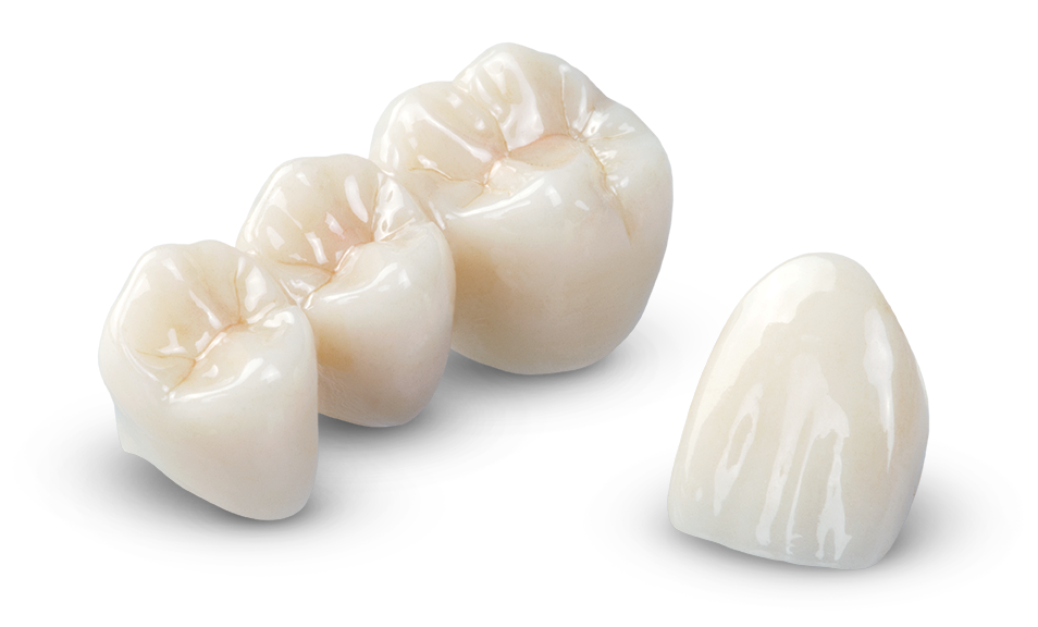 răng sứ Diamond - Nhakhoario