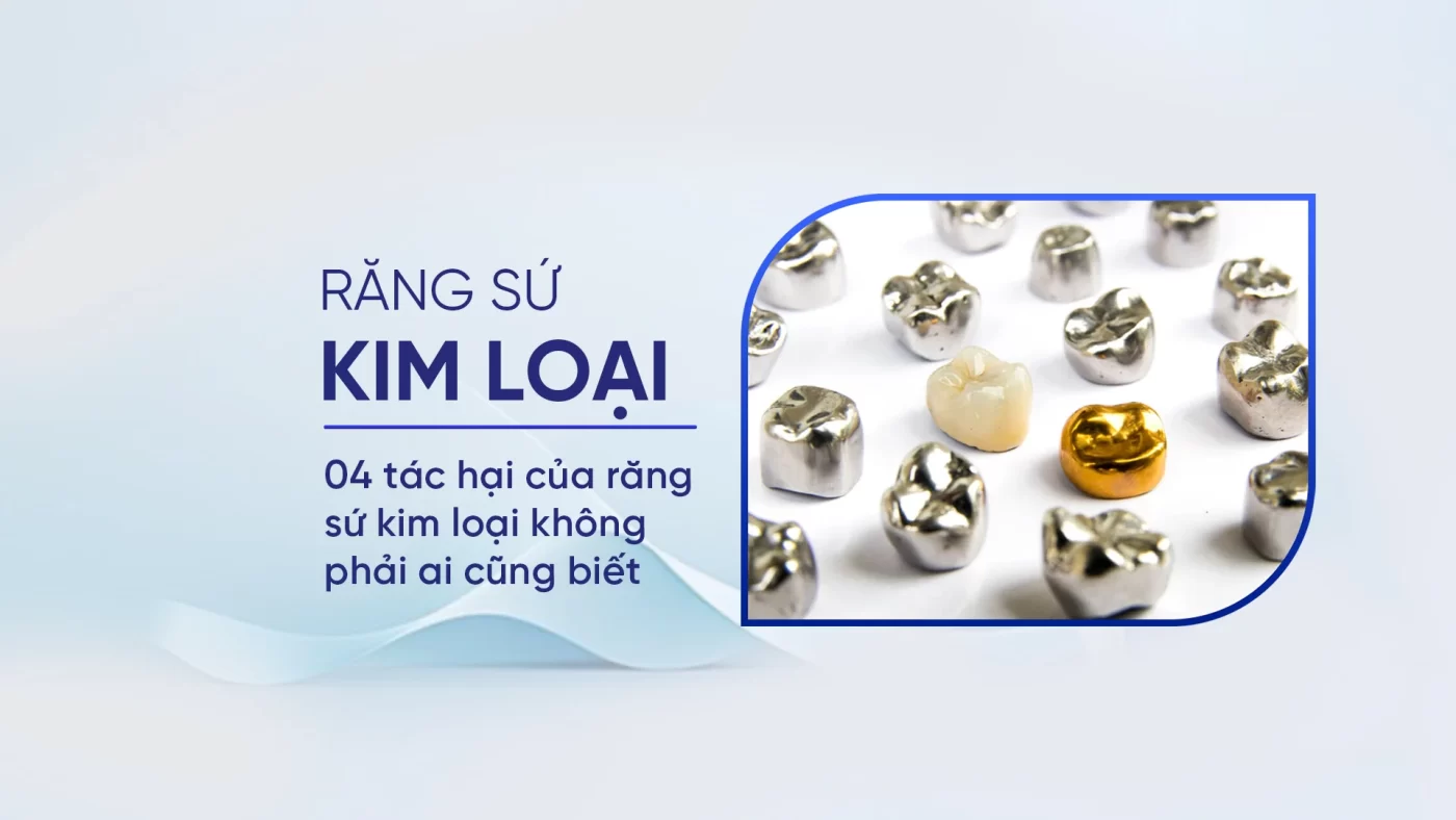 04 Tác hại của răng sứ kim loại