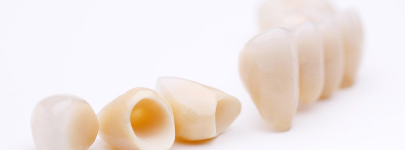 Răng sứ toàn sứ có khả năng chịu lực tốt, đảm bảo chức năng ăn nhai hiệu quả Răng sứ toàn sứ có khả năng chịu lực tốt, đảm bảo chức năng ăn nhai hiệu quả