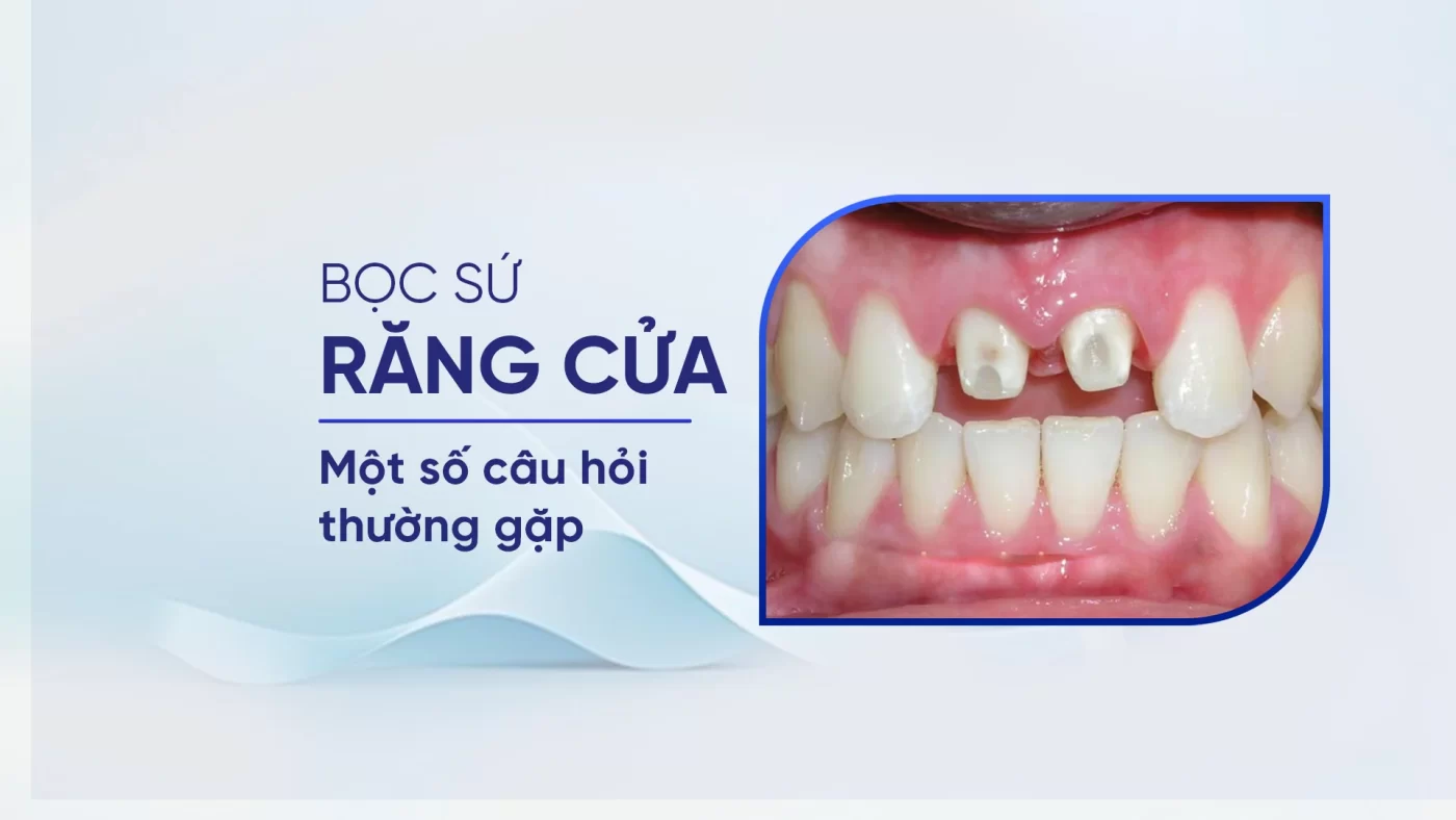 boc-su-rang-cua